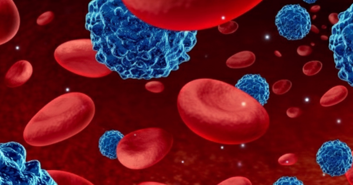 Dupixent Lymphoma Lawsuit